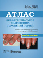 Дифференциальная диагностика поражений ногтей