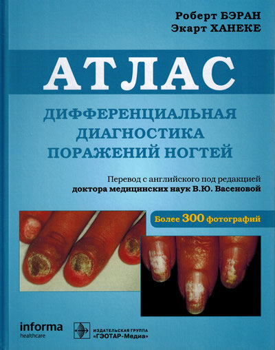 Дифференциальная диагностика поражений ногтей. 2-е издание