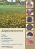 dermatoscopia-johr.jpg