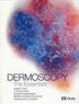dermoscopy-eng.jpg