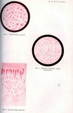 Вклейка в Советский журнал венерологии и дерматологии, 6 выпуск за 1934 г.
