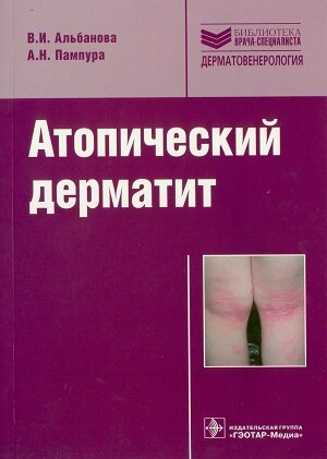 Атопический дерматит. Альбанова В.И., Пампура А.Н.
