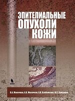 Эпителиальные опухоли кожи