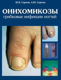 Онихомикозы: грибковые инфекции ногтей, М. 1998