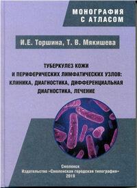 Туберкулез кожи и периферических лимфатических узлов