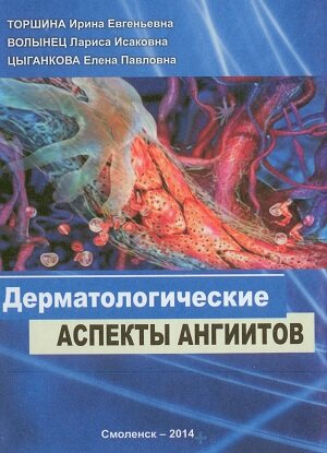 Дерматологические аспекты ангиитов. Торшина И.Е., Волынец Л.И., Цыганкова Е.П.