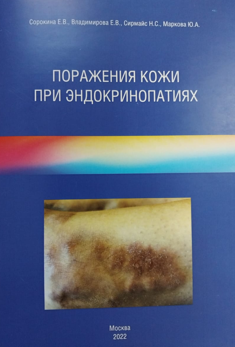 Кожные появления эндокринопатий