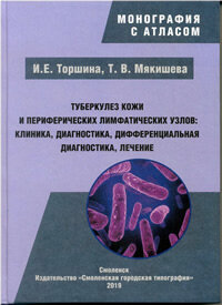 Туберкулез кожи