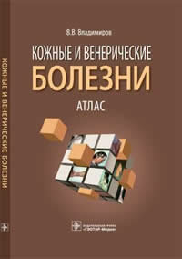 Кожные и венерические болезни. Атлас