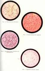 Вклейка в Советский журнал венерологии и дерматологии, 6 выпуск за 1934 г.