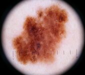 Reticular_pattern2.JPG