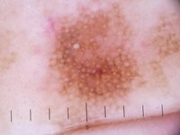 Reticular_pattern3.JPG
